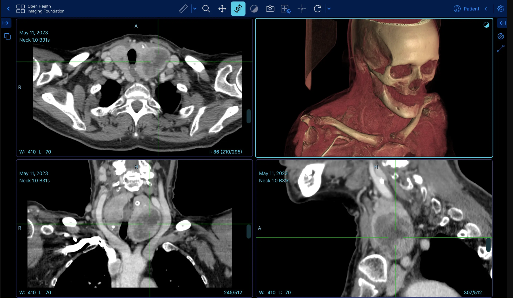MedCloud Pacs — Visualizador DICOM con reconstrucción 3D Volume Rendering